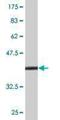 Trefoil Factor 2 antibody, H00007032-M01, Novus Biologicals, Western Blot image 