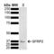 Secreted frizzled-related protein 2 antibody, LS-C776391, Lifespan Biosciences, Western Blot image 