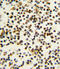Nucleophosmin 1 antibody, A00450, Boster Biological Technology, Immunohistochemistry paraffin image 