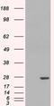 Glutathione S-Transferase Pi 1 antibody, NB100-1792, Novus Biologicals, Western Blot image 