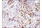 MutS Homolog 6 antibody, 12988S, Cell Signaling Technology, Immunohistochemistry paraffin image 