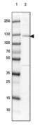 EMAP Like 4 antibody, NBP2-39055, Novus Biologicals, Western Blot image 