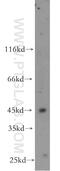 UDP-GlcNAc:BetaGal Beta-1,3-N-Acetylglucosaminyltransferase 5 antibody, 20422-1-AP, Proteintech Group, Western Blot image 