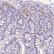 Regenerating Family Member 3 Alpha antibody, NBP2-56947, Novus Biologicals, Immunohistochemistry paraffin image 