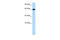 Bestrophin 4 antibody, 28-287, ProSci, Western Blot image 