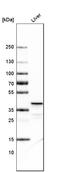 Ornithine Carbamoyltransferase antibody, AMAb91265, Atlas Antibodies, Western Blot image 