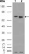 Estrogen Receptor 1 antibody, abx010734, Abbexa, Enzyme Linked Immunosorbent Assay image 