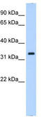 Neutrophil Cytosolic Factor 4 antibody, TA338965, Origene, Western Blot image 