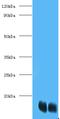 Fatty Acid Binding Protein 1 antibody, MBS7001378, MyBioSource, Western Blot image 
