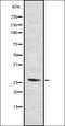 Proteasome Subunit Alpha 5 antibody, orb337148, Biorbyt, Western Blot image 
