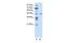 Proteasome 26S Subunit, ATPase 2 antibody, GTX30806, GeneTex, Western Blot image 