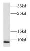 NADH:Ubiquinone Oxidoreductase Subunit A3 antibody, FNab05606, FineTest, Western Blot image 