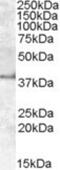 Apolipoprotein L6 antibody, NBP1-36935, Novus Biologicals, Western Blot image 