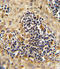 Receptor Tyrosine Kinase Like Orphan Receptor 2 antibody, LS-C99124, Lifespan Biosciences, Immunohistochemistry frozen image 