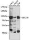 SEC23 Homolog B, Coat Complex II Component antibody, A15131, ABclonal Technology, Western Blot image 