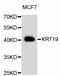 Keratin 19 antibody, abx125355, Abbexa, Western Blot image 