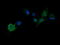 Parvin Alpha antibody, LS-C174641, Lifespan Biosciences, Immunofluorescence image 