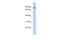 Ankyrin repeat and zinc finger domain-containing protein 1 antibody, A13457, Boster Biological Technology, Western Blot image 