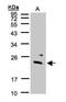 Guanylate Kinase 1 antibody, GTX101812, GeneTex, Western Blot image 