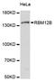 RNA Binding Motif Protein 12B antibody, A14571, Boster Biological Technology, Western Blot image 