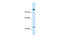 Nuclear Receptor Corepressor 1 antibody, 27-612, ProSci, Western Blot image 