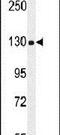 Collagen Type XVIII Alpha 1 Chain antibody, PA5-24199, Invitrogen Antibodies, Western Blot image 