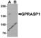 G-protein coupled receptor-associated sorting protein 1 antibody, 7987, ProSci Inc, Western Blot image 