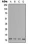 Interleukin 3 antibody, LS-B15827, Lifespan Biosciences, Western Blot image 