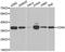 Cyclin Dependent Kinase 6 antibody, STJ23064, St John