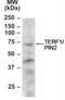 Telomeric Repeat Binding Factor 1 antibody, NB100-891, Novus Biologicals, Western Blot image 