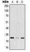 Mediator Complex Subunit 29 antibody, MBS820614, MyBioSource, Western Blot image 