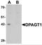 Dolichyl-Phosphate N-Acetylglucosaminephosphotransferase 1 antibody, NBP2-81923, Novus Biologicals, Western Blot image 