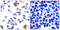 Zeta Chain Of T Cell Receptor Associated Protein Kinase 70 antibody, LS-C199744, Lifespan Biosciences, Immunohistochemistry frozen image 