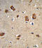 Integrin Subunit Alpha 1 antibody, abx034116, Abbexa, Immunohistochemistry paraffin image 