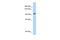 DEAH-Box Helicase 16 antibody, A10183, Boster Biological Technology, Western Blot image 