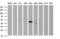 Serpin Family B Member 3 antibody, M04067-1, Boster Biological Technology, Western Blot image 