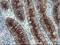 Folate Hydrolase 1 antibody, NBP2-02045, Novus Biologicals, Immunohistochemistry paraffin image 