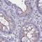 Charged Multivesicular Body Protein 5 antibody, PA5-63303, Invitrogen Antibodies, Immunohistochemistry frozen image 