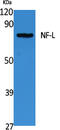 Neurofilament Light antibody, STJ96461, St John