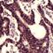 MutS Homolog 2 antibody, PA5-32507, Invitrogen Antibodies, Immunohistochemistry frozen image 