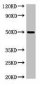 Sphingomyelin Synthase 1 antibody, CSB-PA801243LA01HU, Cusabio, Western Blot image 