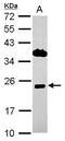 Integral Membrane Protein 2C antibody, PA5-30838, Invitrogen Antibodies, Western Blot image 