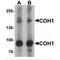 Vacuolar protein sorting-associated protein 13B antibody, MBS151550, MyBioSource, Western Blot image 