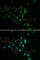 Carnitine Palmitoyltransferase 2 antibody, A2876, ABclonal Technology, Immunofluorescence image 
