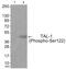 TAL BHLH Transcription Factor 1, Erythroid Differentiation Factor antibody, PA5-37752, Invitrogen Antibodies, Western Blot image 