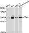 Cyclin Dependent Kinase 4 antibody, abx125018, Abbexa, Western Blot image 