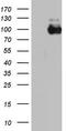 Angiotensin I Converting Enzyme 2 antibody, LS-C338929, Lifespan Biosciences, Western Blot image 