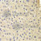 Catechol-O-Methyltransferase antibody, A6200, ABclonal Technology, Immunohistochemistry paraffin image 