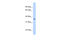 Sarcoglycan Gamma antibody, 29-970, ProSci, Western Blot image 