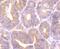 PTTG1 Regulator Of Sister Chromatid Separation, Securin antibody, NBP2-75659, Novus Biologicals, Immunohistochemistry paraffin image 